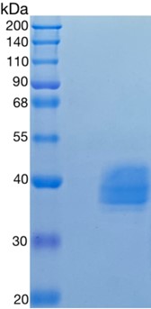 Active Recombinant Human BST1 / CD157 Protein