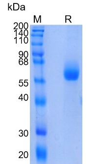 Active Recombinant Human CD161 / KLRB1 Protein