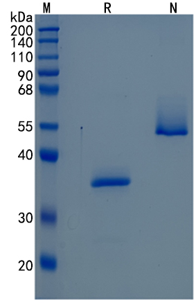 Active Recombinant Human Semaphorin 3B / SEMA3B Protein