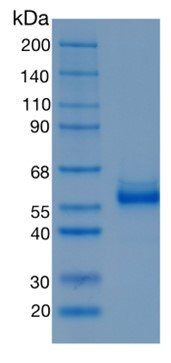 Active Recombinant Human CHIT1 / Chitotriosidase Protein