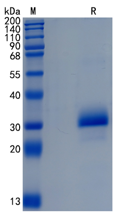 Active Recombinant Human Noggin / NOG Protein