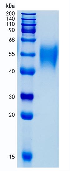 Active Recombinant Human SLAM / CD150 / SLAMF1 Protein