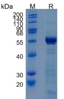 Active Recombinant Human DMP-1 / Dentin Matrix Protein 1 Protein