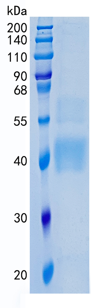 Active Recombinant Human TGF-beta 1 Protein