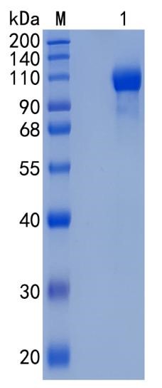 Active Recombinant Human Semaphorin 5A / SEMA5A Protein