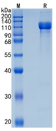 Active Recombinant Human CD166 / ALCAM Protein