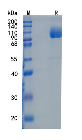 Active Recombinant Human LIMPII / SR-BII / SCARB2 Protein