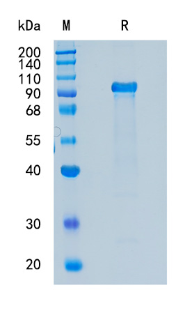 Active Recombinant Human SREC-I / SCARF1 Protein