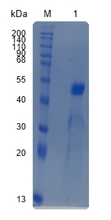 Active Recombinant Human IL-11R alpha / CD130 Protein