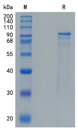Active Recombinant Human Periostin / OSF-2 / POSTN Protein