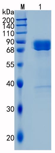 Active Recombinant Human EphA7 / Eph receptor A7 Protein