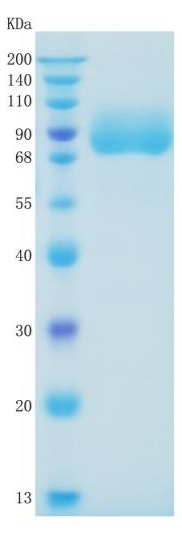 Active Recombinant Human CD226 / DNAM-1 Protein