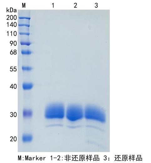 Active Recombinant Human Ephrin-B3 / EFNB3 Protein