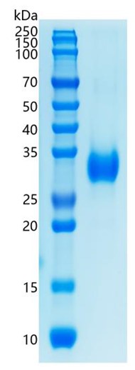 Active Recombinant Human Adiponectin / ACRP30 Protein