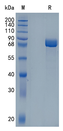 Active Recombinant Human Meprin alpha / MEP1A Protein