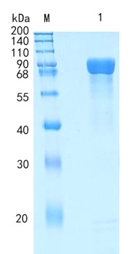 Active Recombinant Human Meprin beta / MEP1B Protein
