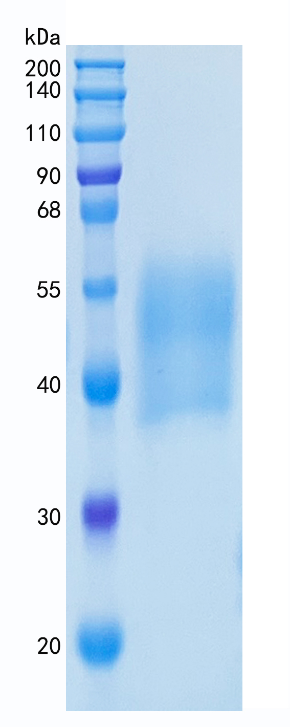 Active Recombinant Mouse M-CSF / CSF1 Protein
