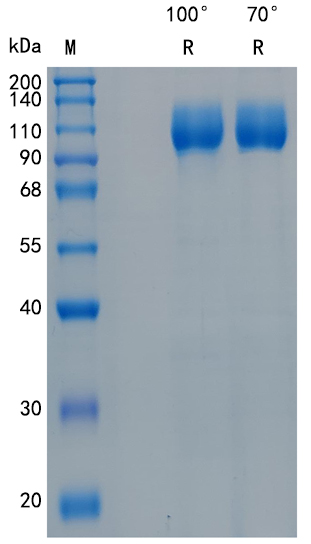 Active Recombinant Mouse CD36 / FAT / GPIV Protein