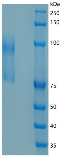 Active Recombinant Mouse CD62L / L-Selectin / SELL Protein