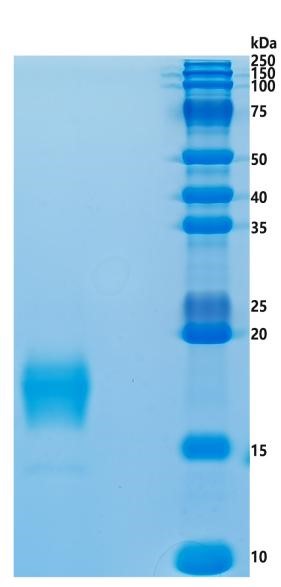 Active Recombinant Human TIGIT / VSTM3 Protein