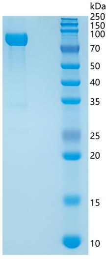 Active Recombinant Mouse CD14 Protein