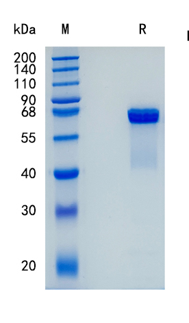 Active Recombinant Mouse Osteopontin / OPN / SPP1 Protein