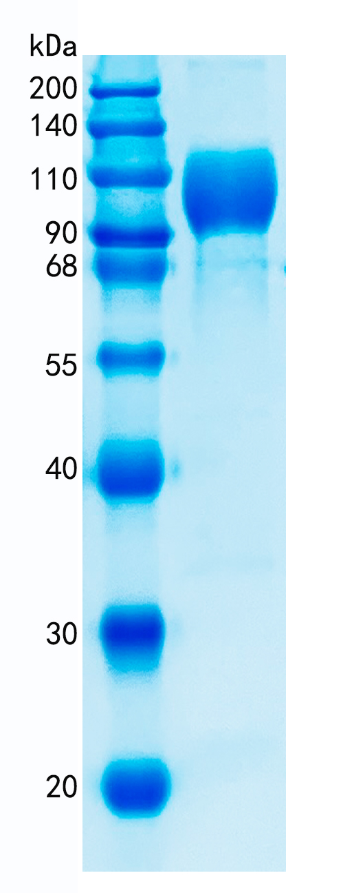 Active Recombinant Human IL-23R / Interleukin-23 Receptor Protein