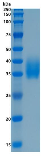 Active Recombinant Human CD276 / B7-H3 Protein