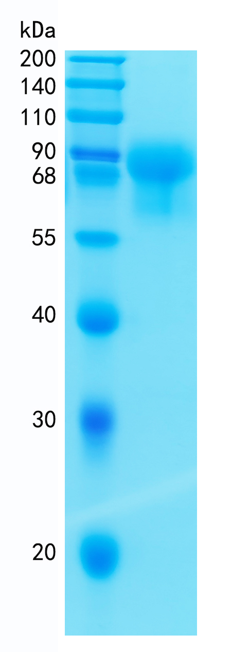 Active Recombinant Mouse IL-15R alpha / CD215 Protein