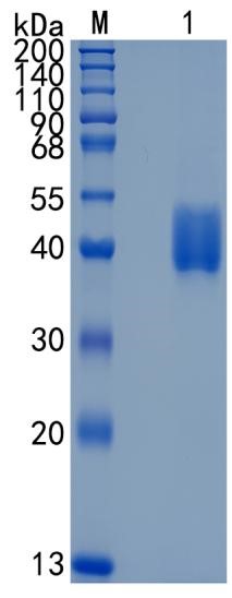 Active Recombinant Mouse Mesothelin / MSLN Protein