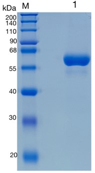 Active Recombinant Mouse LBP / Lipopolysaccharide-binding Protein Protein