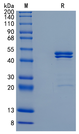 Active Recombinant Mouse IL-11R alpha / CD130 Protein