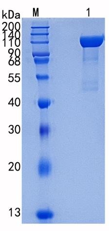 Active Recombinant Human ERAP2 / L-RAP Protein