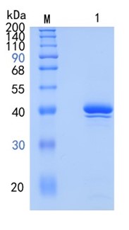 Active Recombinant Human Notum / PABCN Protein