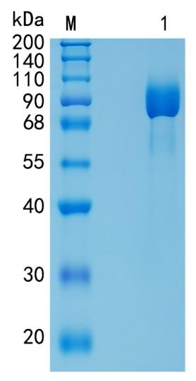 Active Recombinant Mouse CD130 / gp130 / IL-6ST Protein