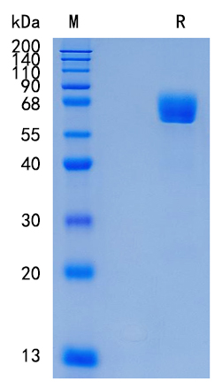 Active Recombinant Human LILRA6 / CD85b / ILT8 Protein