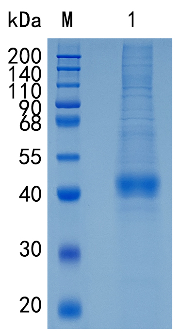 Active Recombinant Mouse FcRn / FCGRT Protein