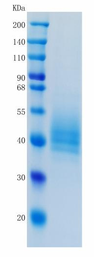 Active Recombinant Human GFR alpha-like / GFRAL Protein