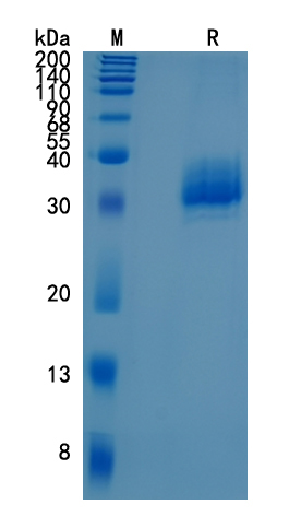 Active Recombinant Human Siglec-15 / CD33L3 Protein