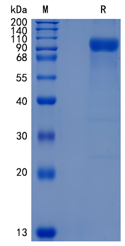 Active Recombinant Human AMIGO2 / Alivin-2 Protein