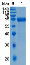 Active Recombinant Mouse NCR1 / NKp46 / CD335 Protein