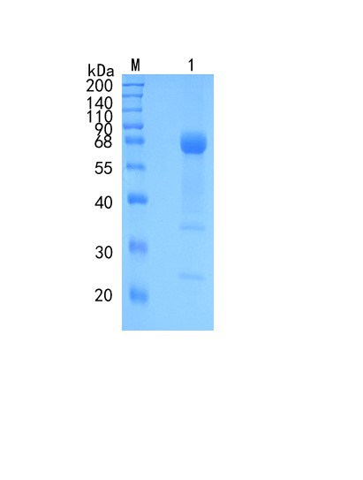 Active Recombinant Human IL-28R alpha / IFN-lambda R1 Protein