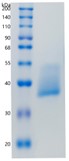 Active Recombinant Human CLEC10A / CD301 Protein