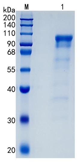Active Recombinant Human NLGN4X / Neuroligin-4 Protein
