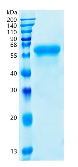Active Recombinant Human FGFRL1 / FGFR5 Protein