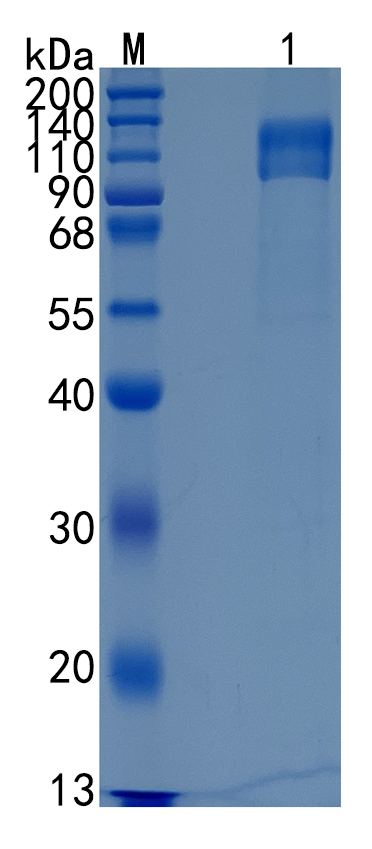 Active Recombinant Human IL-17RC / IL-17 Receptor C Protein