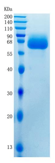Active Recombinant Human LILRB1 / CD85j / ILT2 Protein