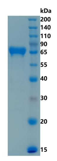 Active Recombinant Mouse CD137 / 4-1BB / TNFRSF9 Protein