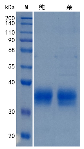Active Recombinant Mouse IL-34 / Interleukin-34 Protein