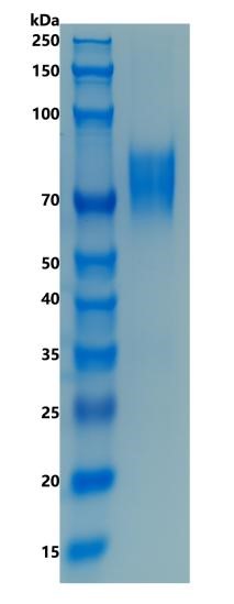 Active Recombinant Human TIM-3 / HAVCR2 Protein